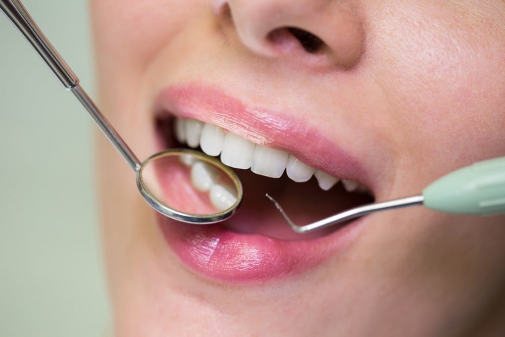 Pinhole Surgery: A Minimally Invasive Gum Recession Solution.