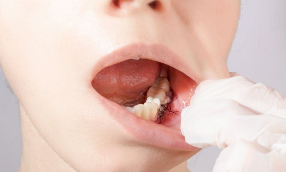 5 Signs You Need Bone or Gum Grafting Guidance from Sound Surgical