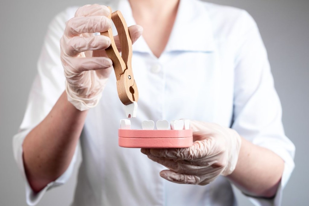 Tooth in a Day Dental Implant Services Revolutionary Solutions in